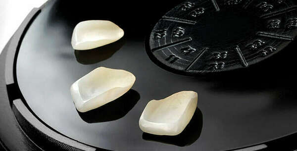 Les facettes dentaires