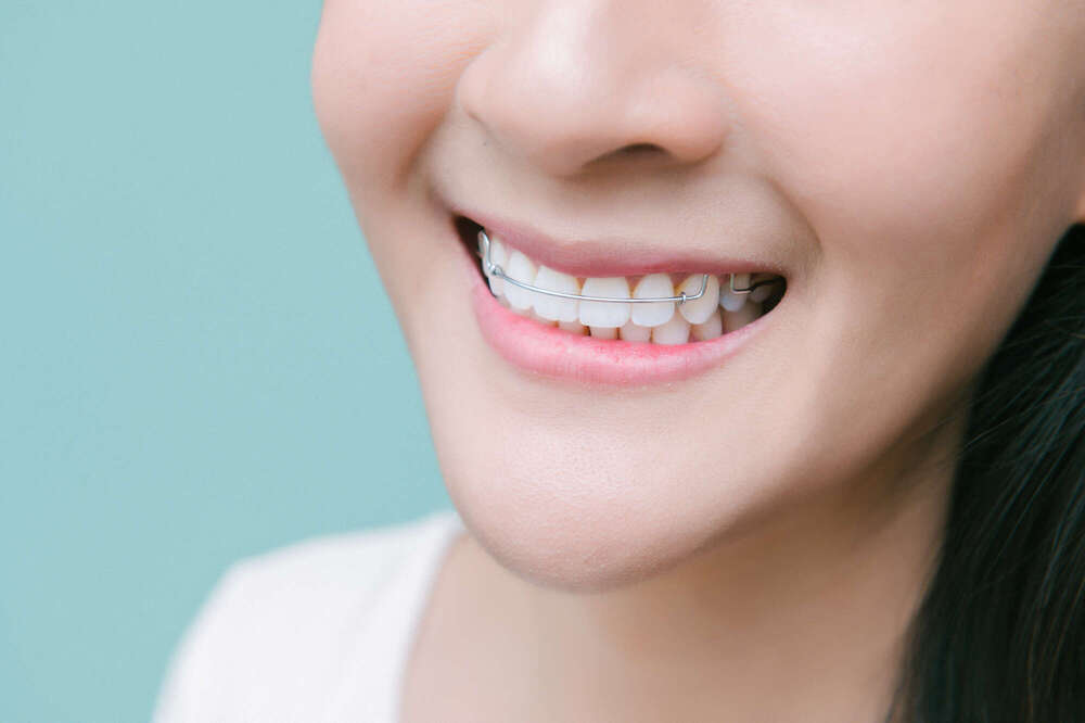 Évolution des remboursements en orthodontie