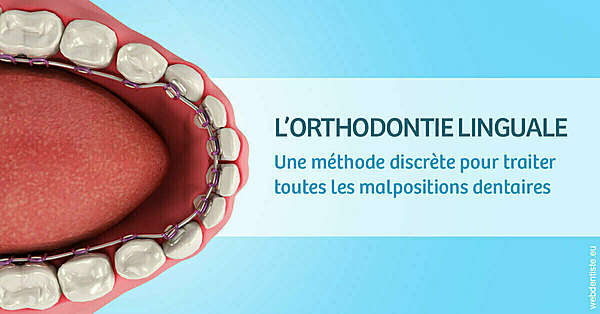 L'orthodontie linguale