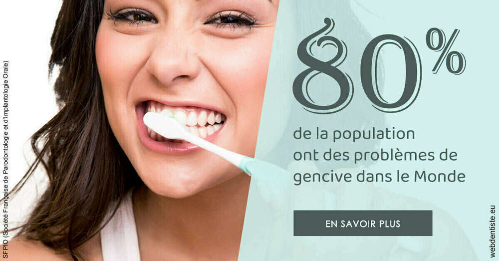 Problèmes de gencive