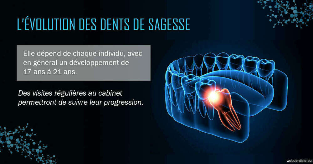 2023 t4 - dents de sagesse