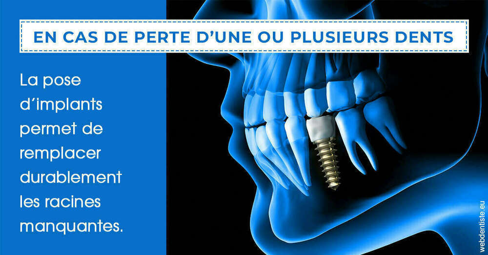 2024 t1 - implants