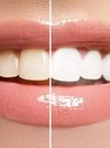 SOURIRE