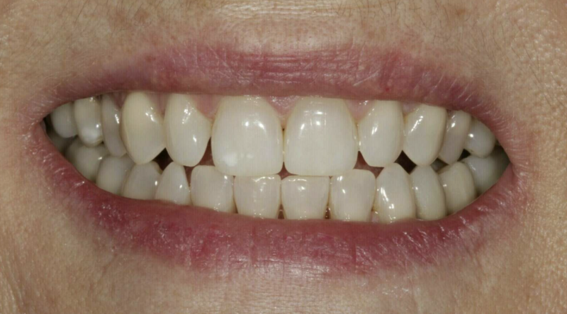 Éclaircissement - Cas cliniques du Dr. Adrien COURONNE à Gap