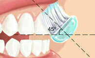 TECHNIQUE DE BROSSAGE DES DENTS
