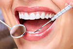 LES IMPLANTS DENTAIRES ET COURONNES SUR IMPLANT RENNES