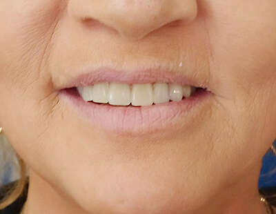 PHOTOS DE CAS CLINIQUES