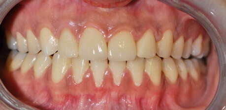 CAS ESTHETIQUES