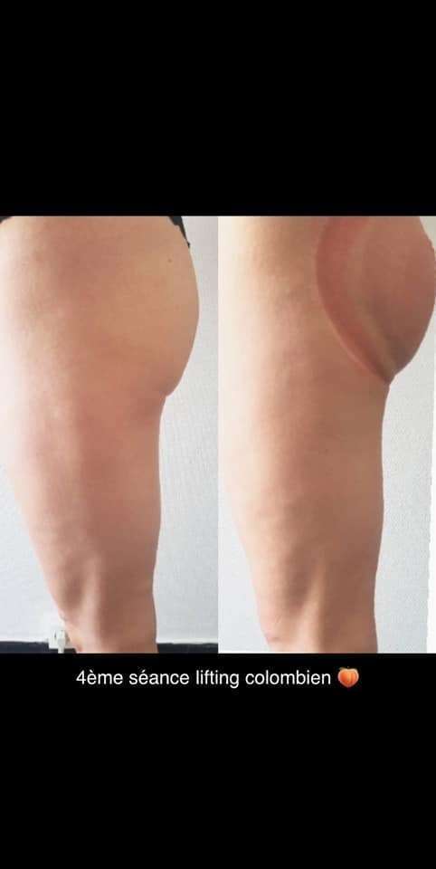 107975174_132122951878621_4659124997769269114_n