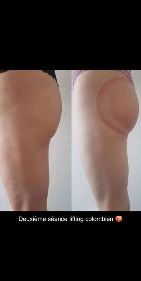 106734731_121787902912126_108905879651864690_n