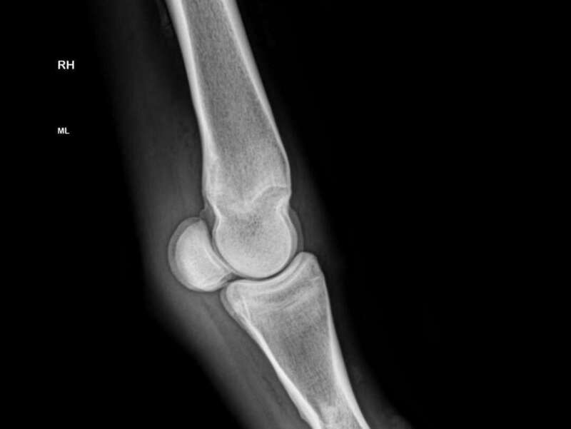 Radiographie