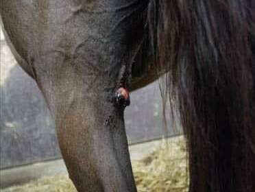 Exerese de masse