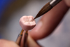 Implants dentaires au Cabinet Dentaire Taverny