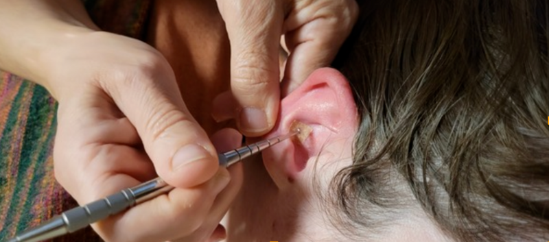 réflexologie auriculaire lyon