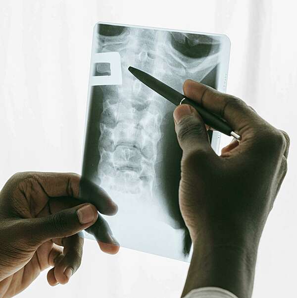 Pourquoi mes vertèbres craquent ? Les réponses du chiropracteur