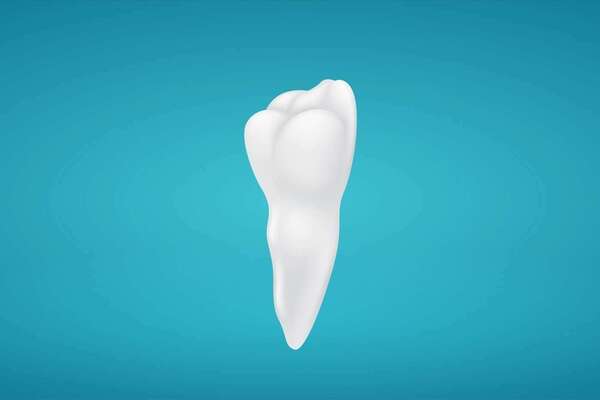 Dégagement orthodontique d’une canine incluse