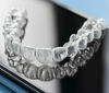 Gouttières transparentes pour traitement orthodontique personnalisé