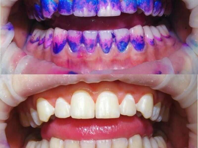 7swcl8gacc_1730183633