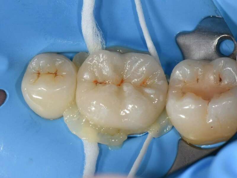 9pvyil9wn1_1598261654