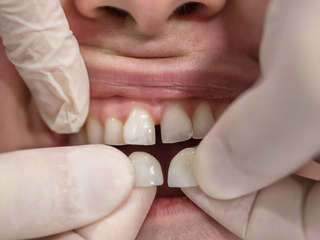 vz87h3vwxb_1607421243