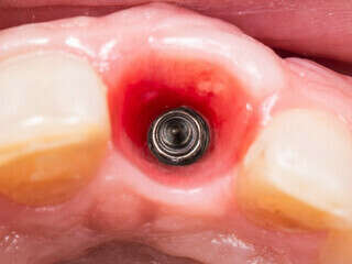 lhe4c3usfm_1675873834