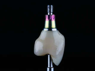 asmvjygklw_1675867777