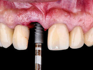 8g3m393c9x_1675526687