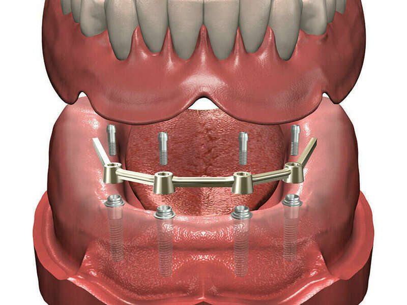 dzd6ec8ucq_1601558548