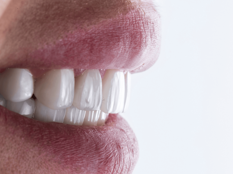 vot2rexozo_1738859504