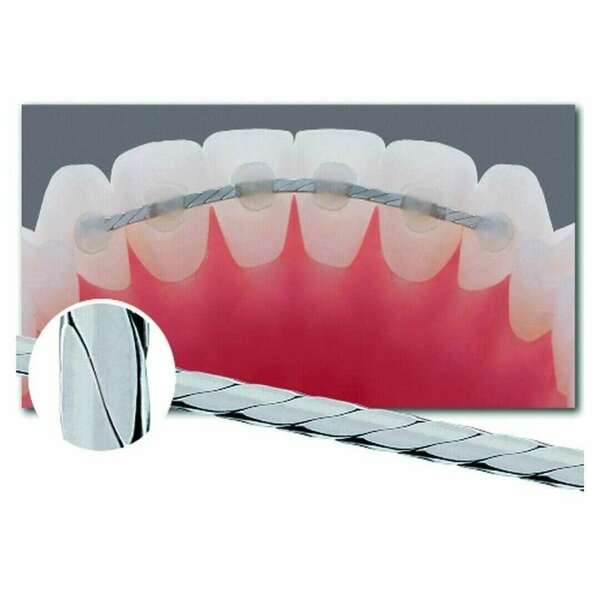 Contentions parodontales