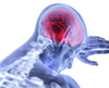ostéopathe pour les cervicales