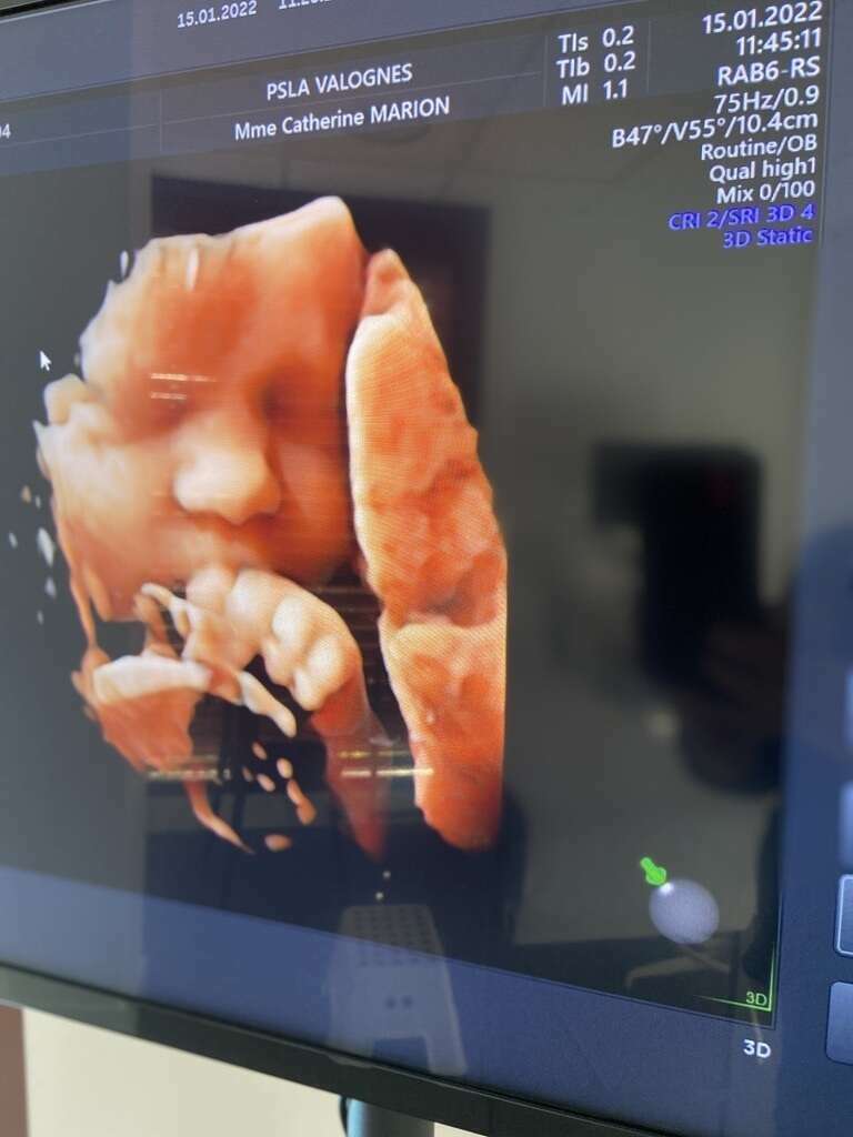 c9c5407a-e217-406e-8d22-72e0bdb16406_1_105_c