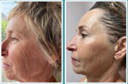 capture_d_ecran_2023-10-18_162901