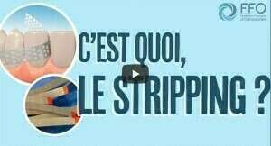 Orthodontie : c’est quoi, le stripping ?