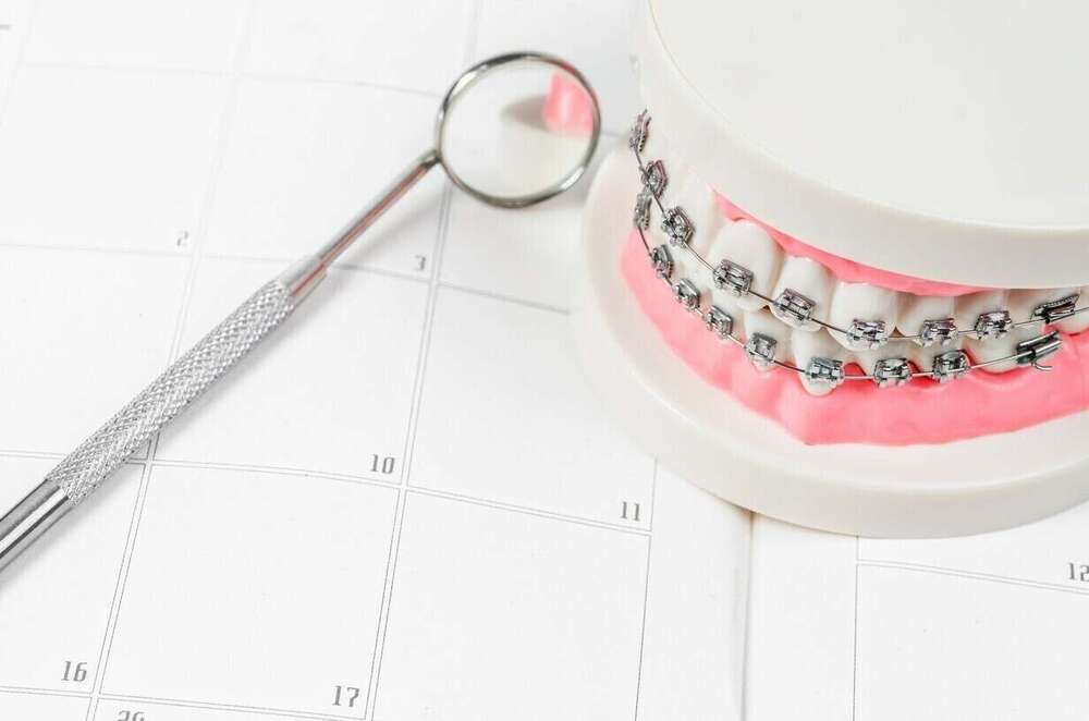 Conditions de réussite d'un traitement orthodontique