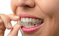 ORTHODONTIE PAR ALIGNEURS