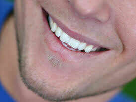 ORTHODONTIE INVISALIGN VALENCE