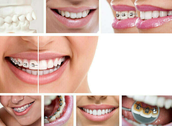 L'ORTHODONTIE