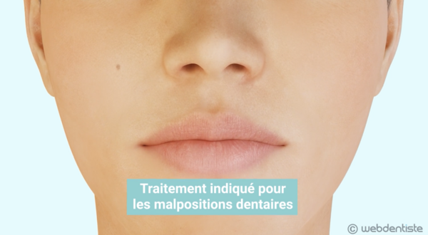 Traitement orthodontique - appareil autoligaturant en céramique
