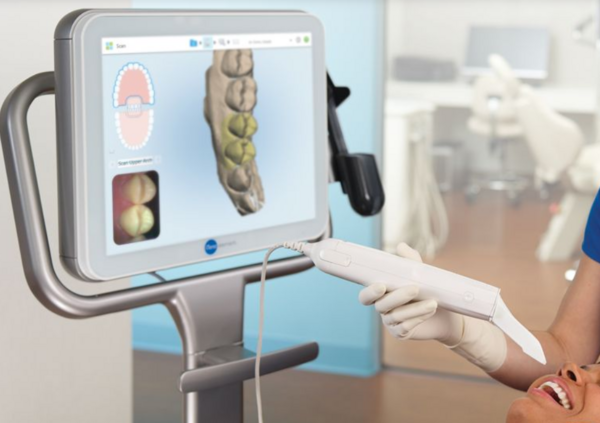 L'EMPREINTE OPTIQUE EN ORTHODONTIE