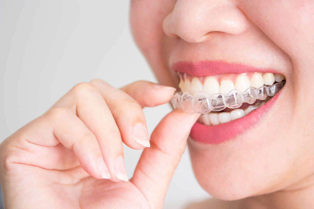 Orthodontiste Montmartre - Dr Jean-Marc BELLAICHE à Paris 18