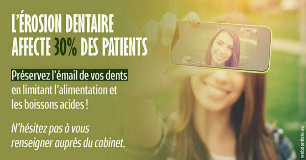 L'érosion dentaire