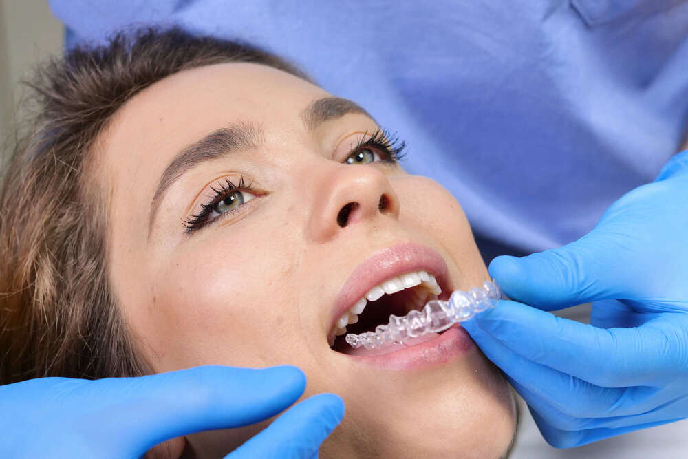 Orthodontie adulte Montmatre Paris 18