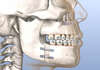 orthodontie paris 18 a montmartre