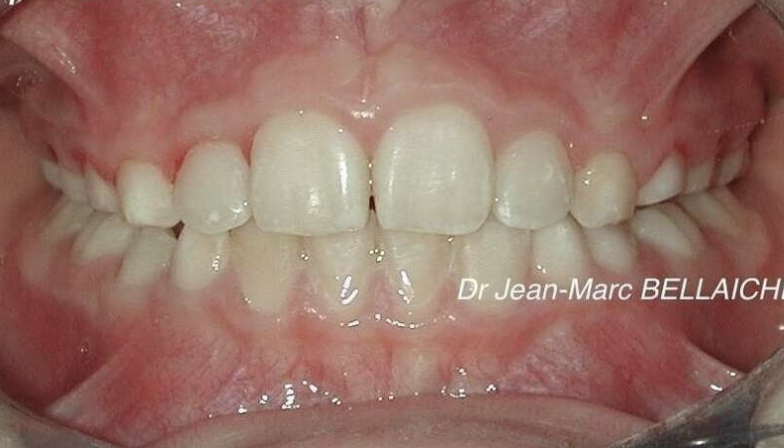 orthodontie paris 18