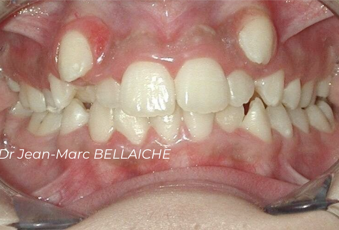 orthodontiste montmartre paris 18