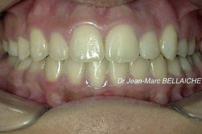 orthodontiste montmartre paris 18