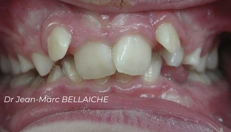 orthodontiste paris 18