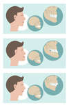 traitements ortho chirurgical montmatre