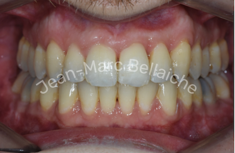 orthodontie montmartre